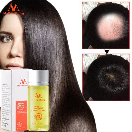 Beauty Qiong Hair Growth Nut Essential Oil for Hair Care