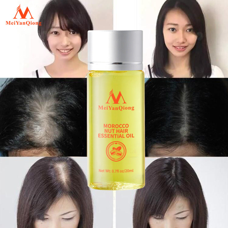 Beauty Qiong Hair Growth Nut Essential Oil for Hair Care